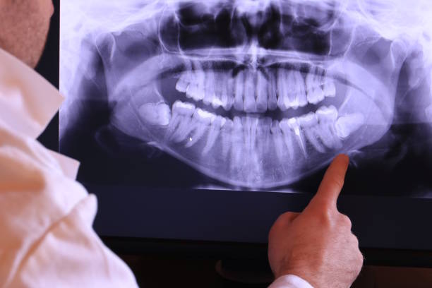 Best Cosmetic Emergency Dentistry in Nashotah, WI
