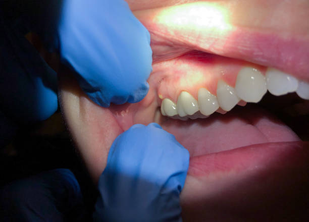 Best Same-Day Emergency Dental Services in Nashotah, WI